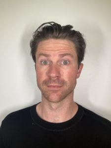 before daxxify treatment to forehead