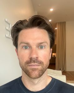 after daxxify treatment to forehead